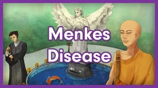 Menkes Disease  USMLE Step 1 Mnemonic [upl. by Harihs494]