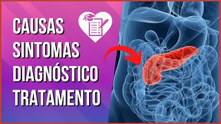 PANCREATITE  Causas Sintomas e Tratamento [upl. by Aikahc]