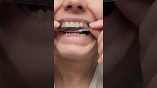 How to make your teeth white without sensitivity  چگونه دندان هایتان راسفید کنید shorts teeth [upl. by Gabriel521]