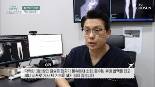 혈액에 즉각 흡수되는 빠른 뼈🦴 형성 도우미 ❝액상 칼슘❞ TV CHOSUN 20220430 방송  글로벌 힐링 최고의 선택 44회  TV조선 [upl. by Sucramaj]