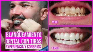 DIENTES más BLANCOS en 30 minutos con TIRAS BLANQUEADORAS  EXPERIENCIA y CONSEJOS [upl. by Ciapha773]