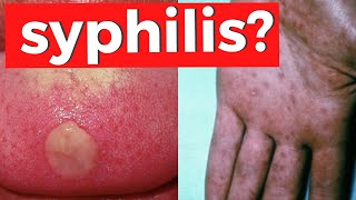 SYPHILIS  Everything You Need To Know about Treponema Pallidum [upl. by Atirahc]