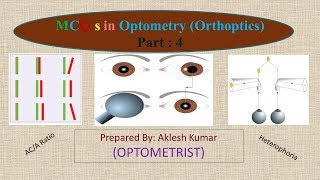 MCQ in Optometry Orthoptics part 4 [upl. by Sik167]