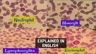 NeutrophilLymphocytemonocyte amp eosinophil actual view under microscopehow to differentiate easily [upl. by Ebarta]