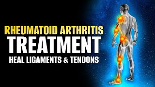 Rheumatoid Arthritis Treatment  Heal Ligaments And Tendons  Muscles Bones Joints amp Nerves Healing [upl. by Godwin]