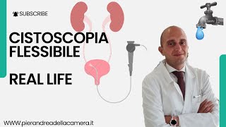 REAL LIFE CISTOSCOPIA FLESSIBILE [upl. by Beshore]