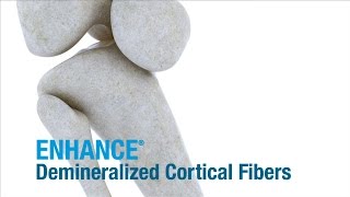 Enhance® Demineralized Cortical Fibers  ConMed Product Video [upl. by Ruhtracm577]