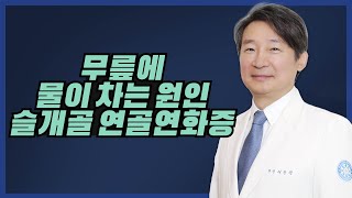 관절무릎 무릎에 물이 차는 원인 슬개골 연골연화증 [upl. by Nelli]