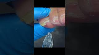 Wonderful Pedicure Video pedicure satisfying [upl. by Ethel255]