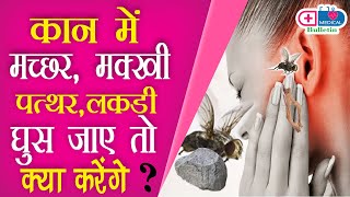 ENT Part 4 कान में मच्छर मक्खी लकड़ी घुस जाये तो क्या करेंगे Dr Manish Munjal  Medical Bulletin [upl. by Suilienroc]