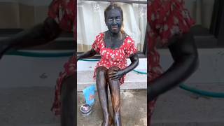 Gore Hone ki Home Remedy  The Casual shoes youtubeshorts whitecolour skincolourtransformation [upl. by Netsrek525]