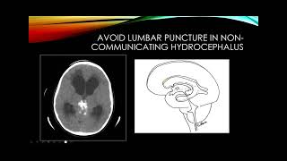 Cerebrospinal fluid [upl. by Spalding]