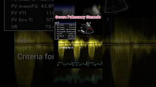 Pulmonary Stenosis on Echocardiography anatomy cardiology shorts [upl. by Ratcliffe]