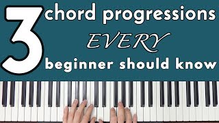 Common Chord Progressions Every Beginner Should Know [upl. by Vershen285]