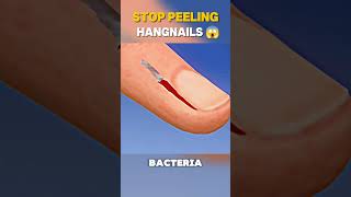 Stop PEELING Hangnailshangnailpeeling [upl. by Orelia]