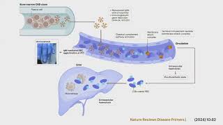 Webinaire AIH  Anémie hémolytique autoimmune [upl. by Giuseppe795]