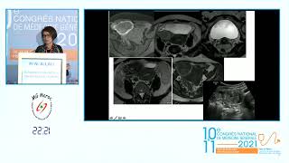 Séance de Radiologie Echographie du pelvis à travers des cas cliniques Pr Nazik Allali [upl. by Quillon]