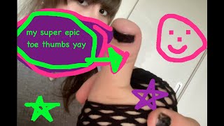 my super epic thumbs brachydactyly type d yay [upl. by Plunkett]