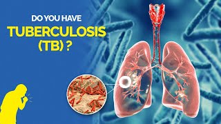 What is Tuberculosis TB Symptoms Causes Diagnosis and Treatment [upl. by Oker]