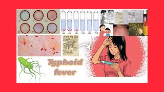 Typhoid fever everything we want to know [upl. by Siusan]