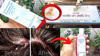 How to Use Ketoconazole Shampoo 2  Jan Aushadhi Kendra Ketoconazole Shampoo Benefits [upl. by Rafael]