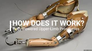 How Does a Body Powered Upper Limb Prostheses Work [upl. by Nonnerb]