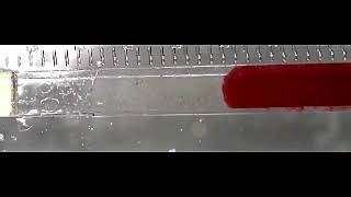 BLOOD PLASMA SEPARATION [upl. by Betteanne]