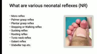 Neonatal Reflex  Plantar Grasp Reflex  Pediatrics [upl. by Africah]