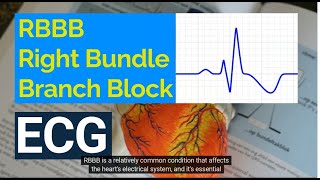 Understanding Right Bundle Branch Block RBBB on ECG Causes Symptoms and Treatment [upl. by Allemrac317]