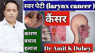 गले के कैंसर का प्रकार। type of larynx cancer  Larynx cancer cause n treatment [upl. by Nilyak216]