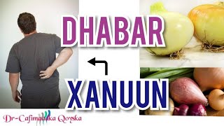 Dhabar Xanuunka Oo Xal Waara Loo Helay [upl. by Eudoca]