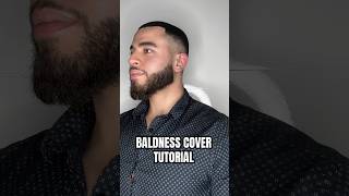 How to cover your baldness  baldness baldnesssolution haircare [upl. by Moulton]