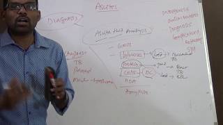 PATHOPHYSIOLOGY OF ASCITES [upl. by Wachtel]