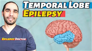 Temporal Lobe Epilepsy Diagnosis and Treatment [upl. by Ennaear388]