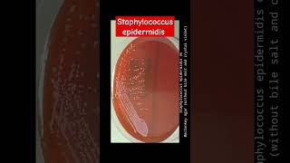 Staphylococcus epidermidis growth on various culture media wet mount and Gram Staining [upl. by Gnof]