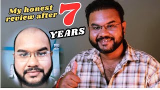 MY HAIR TRANSPLANT REVIEW AFTER 7 YEARS  HOW YOU CAN MAINTAIN YOUR LOOK LIFE LONG hairtransplant [upl. by Naujyt376]