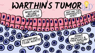 Warthins tumor [upl. by Pepita]