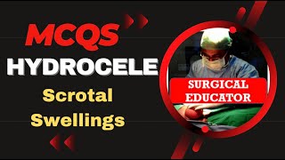 MCQs HYDROCELE Scrotal Swellings [upl. by Lagasse]