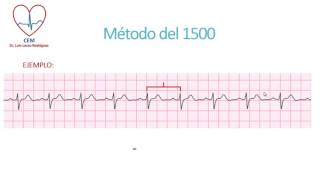 Calculo de la frecuencia cardíaca en un ECG [upl. by Moffat]