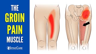 The Groin Pain Muscle How to Release It for INSTANT RELIEF [upl. by Eilatan847]