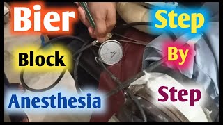 bier block anesthesia [upl. by Irep337]