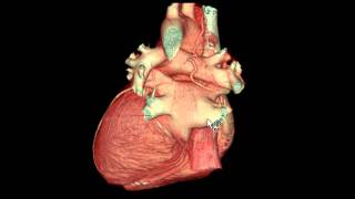 External Features of the Heart in 3D [upl. by Esinereb861]