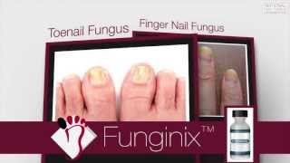 Funginix Review  Toenail Fungus Treatment Review [upl. by Yorker]