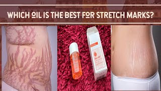 Which oil is the best for stretch marks BioOil Original Skincare Oil 🌟Honest Review🌟 [upl. by Lidia]