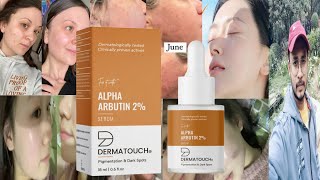 Dermatouch Alpha Arbutin Serum  Honest Review [upl. by Etnaik]