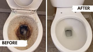 Extreme Toilet Deep Cleaning The Most Disgusting Toilet I’ve Cleaned [upl. by Anirres]