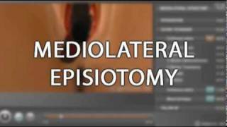 Trailer  Chapter on Episiotomy [upl. by Eirod572]