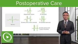 Postoperative Care – Surgery  Lecturio [upl. by Garlen558]