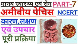 अमीबिएसिस या अमीबीय पेचिश।। What is amoebiasis or amoebic dysentery in Hindi Biology [upl. by Oskar]