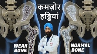 WEAK BONES  Reason to Remedy  OSTEOPOROSIS  DrEducation Hindi  Eng Subs [upl. by Jilly640]